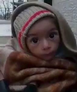 madaya starving child